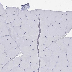 Invitrogen CD162 (PSGL-1) Polyclonal Antibody 100 &mu;L; Unconjugated:Antibodies,