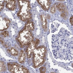 Invitrogen ENPP6 Polyclonal Antibody 100 &mu;L; Unconjugated:Antibodies,