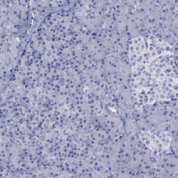 Invitrogen ENPP6 Polyclonal Antibody 100 &mu;L | Buy Online | Invitrogen&trade; | Fisher Scientific