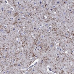 Invitrogen ENPP6 Polyclonal Antibody 100 &mu;L; Unconjugated:Antibodies,