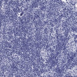 Invitrogen Glypican 1 Polyclonal Antibody 100 &mu;L | Buy Online | Invitrogen&trade; | Fisher Scientific