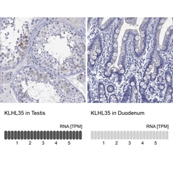 Invitrogen KLHL35 Polyclonal Antibody 100 &mu;L; Unconjugated:Antibodies,