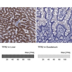 Invitrogen TFR2 Polyclonal Antibody 100 &mu;L; Unconjugated:Antibodies,