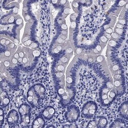 Invitrogen TFR2 Polyclonal Antibody 100 &mu;L; Unconjugated:Antibodies,