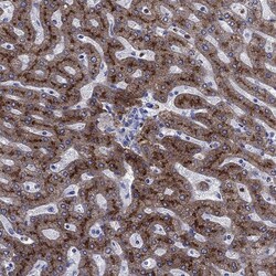 Invitrogen TFR2 Polyclonal Antibody 100 &mu;L; Unconjugated:Antibodies,