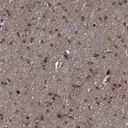 Invitrogen CNDP1 Polyclonal Antibody 100 &mu;L | Buy Online | Invitrogen&trade; | Fisher Scientific