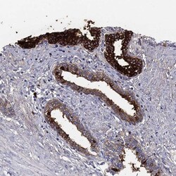 Invitrogen TGM4 Polyclonal Antibody 100 μL; Unconjugated:Antibodies,