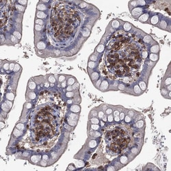 Invitrogen DOCK8 Polyclonal Antibody 100 &mu;L; Unconjugated:Antibodies,