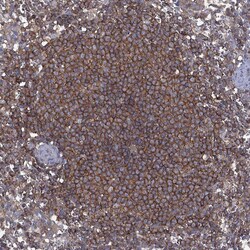 Invitrogen DOCK8 Polyclonal Antibody 100 &mu;L; Unconjugated:Antibodies,