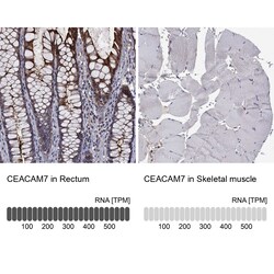 Invitrogen CEACAM7 Polyclonal Antibody 100 &mu;L; Unconjugated:Antibodies,