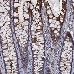Invitrogen CEACAM7 Polyclonal Antibody 100 &mu;L; Unconjugated:Antibodies,