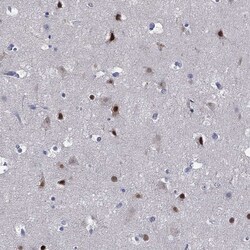 Invitrogen ZNF238 Polyclonal Antibody 100 &mu;L | Buy Online | Invitrogen&trade; | Fisher Scientific