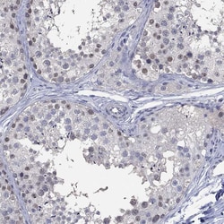 Invitrogen ZNF238 Polyclonal Antibody 100 &mu;L | Buy Online | Invitrogen&trade; | Fisher Scientific