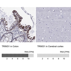 Invitrogen TRIM31 Polyclonal Antibody 100 &mu;L; Unconjugated:Antibodies,