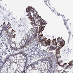 Invitrogen TRIM31 Polyclonal Antibody 100 &mu;L; Unconjugated:Antibodies,