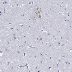 Invitrogen PHF21B Polyclonal Antibody 100 &mu;L; Unconjugated:Antibodies,
