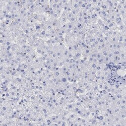 Invitrogen PHF21B Polyclonal Antibody 100 &mu;L; Unconjugated:Antibodies,
