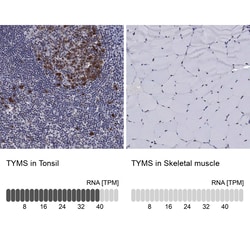 Invitrogen Thymidylate Synthase Polyclonal Antibody 100 &mu;L; Unconjugated:Antibodies,