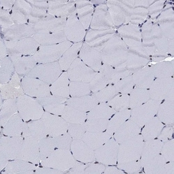 Invitrogen Thymidylate Synthase Polyclonal Antibody 100 &mu;L; Unconjugated:Antibodies,
