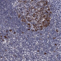 Invitrogen Thymidylate Synthase Polyclonal Antibody 100 &mu;L; Unconjugated:Antibodies,
