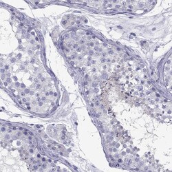 Invitrogen Fascin-3 Polyclonal Antibody 100 &mu;L; Unconjugated:Antibodies,
