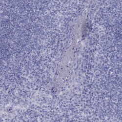 Invitrogen Fascin-3 Polyclonal Antibody 100 &mu;L; Unconjugated:Antibodies,