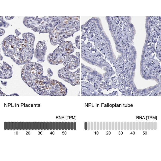 NPL Polyclonal Antibody, Invitrogen 100 μL; Unconjugated:Antibodies, |  Fisher Scientific