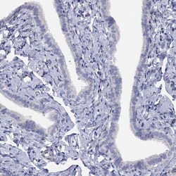 Invitrogen NPL Polyclonal Antibody 100 &mu;L; Unconjugated:Antibodies,