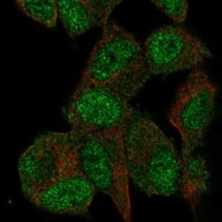 Invitrogen CENTG1 Polyclonal Antibody 100 &mu;L; Unconjugated:Antibodies,