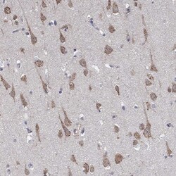 Invitrogen CENTG1 Polyclonal Antibody 100 &mu;L; Unconjugated:Antibodies,