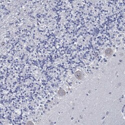 Invitrogen USP29 Polyclonal Antibody 100 &mu;L; Unconjugated:Antibodies,