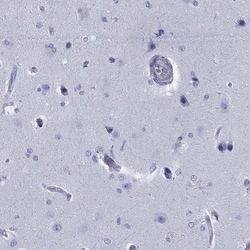 Invitrogen RGS13 Polyclonal Antibody 100 &mu;L; Unconjugated:Antibodies,