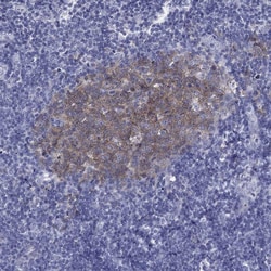 Invitrogen RGS13 Polyclonal Antibody 100 &mu;L; Unconjugated:Antibodies,