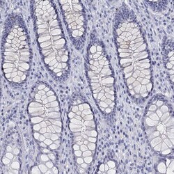 Invitrogen MAGEB6 Polyclonal Antibody 100 &mu;L; Unconjugated:Antibodies,