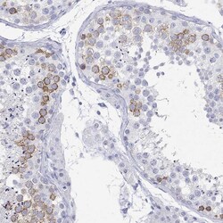 Invitrogen MAGEB6 Polyclonal Antibody 100 &mu;L; Unconjugated:Antibodies,