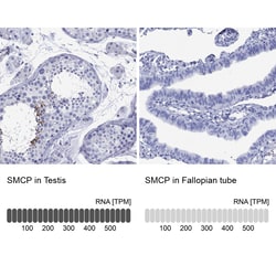 Invitrogen SMCP Polyclonal Antibody 100 &mu;L; Unconjugated:Antibodies,