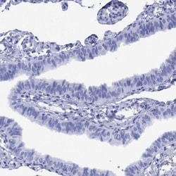 Invitrogen SMCP Polyclonal Antibody 100 &mu;L; Unconjugated:Antibodies,