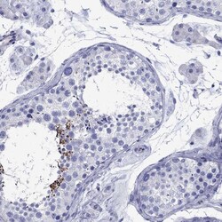 Invitrogen SMCP Polyclonal Antibody 100 &mu;L; Unconjugated:Antibodies,