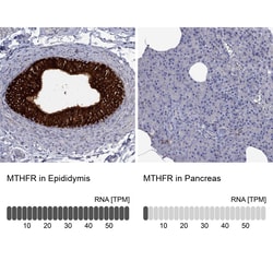 Invitrogen MTHFR Polyclonal Antibody 100 &mu;L; Unconjugated:Antibodies,