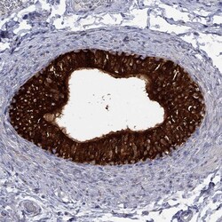 Invitrogen MTHFR Polyclonal Antibody 100 &mu;L; Unconjugated:Antibodies,