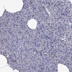 Invitrogen MTHFR Polyclonal Antibody 100 &mu;L; Unconjugated:Antibodies,