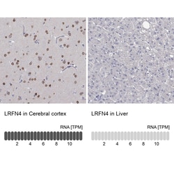 Invitrogen LRFN4 Polyclonal Antibody 100 &mu;L; Unconjugated:Antibodies,