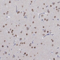 Invitrogen LRFN4 Polyclonal Antibody 100 &mu;L; Unconjugated:Antibodies,