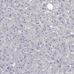 Invitrogen LRFN4 Polyclonal Antibody 100 &mu;L; Unconjugated:Antibodies,