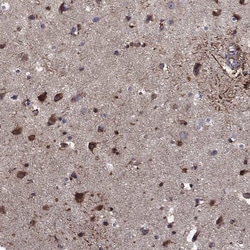 Invitrogen CLSTN1 Polyclonal Antibody 100 &mu;L; Unconjugated:Antibodies,