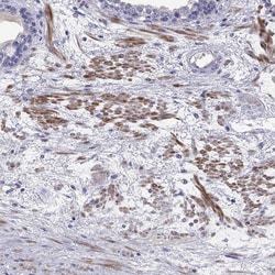 Invitrogen CMYA5 Polyclonal Antibody 100 &mu;L; Unconjugated:Antibodies,