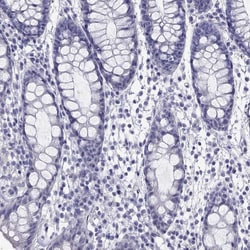 Invitrogen CMYA5 Polyclonal Antibody 100 &mu;L; Unconjugated:Antibodies,