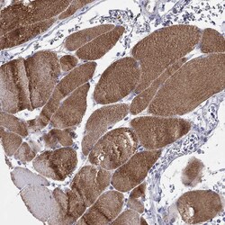 Invitrogen CMYA5 Polyclonal Antibody 100 &mu;L; Unconjugated:Antibodies,