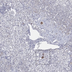 Invitrogen MC2R Polyclonal Antibody 100 μL; Unconjugated:Antibodies,
