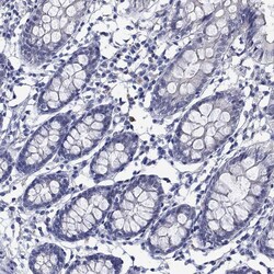 Invitrogen MC2R Polyclonal Antibody 100 μL; Unconjugated:Antibodies,